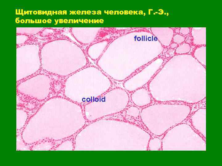 Щитовидная железа человека, Г. -Э. , большое увеличение follicle colloid 