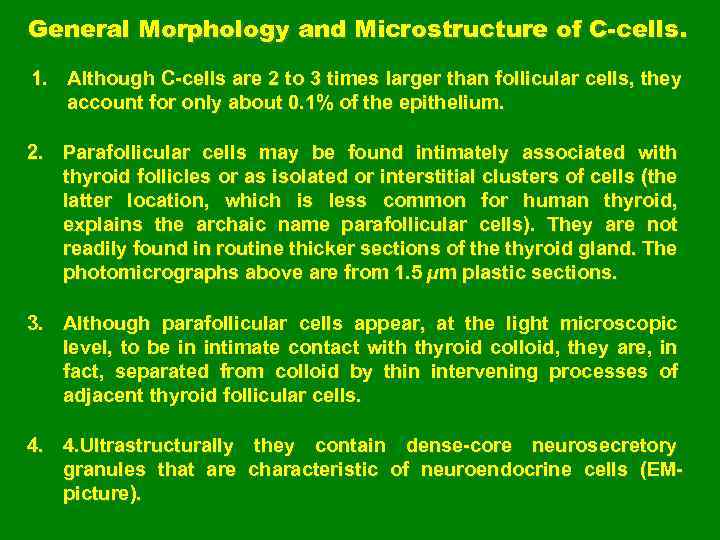 General Morphology and Microstructure of C-cells. 1. Although C-cells are 2 to 3 times