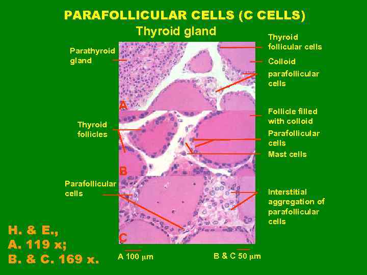 PARAFOLLICULAR CELLS (C CELLS) Thyroid gland Thyroid follicular cells Parathyroid gland Colloid parafollicular cells