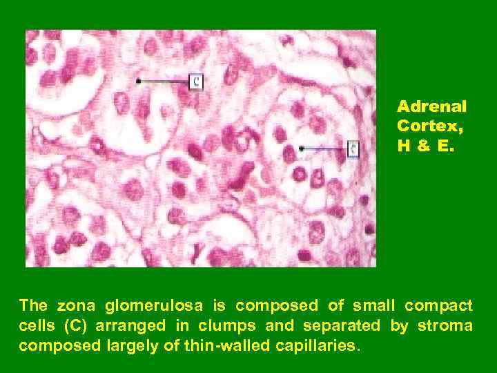 Adrenal Cortex, H & E. The zona glomerulosa is composed of small compact cells