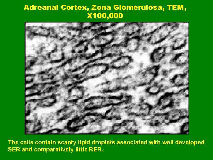 Adreanal Cortex, Zona Glomerulosa, TEM, X 100, 000 The cells contain scanty lipid droplets