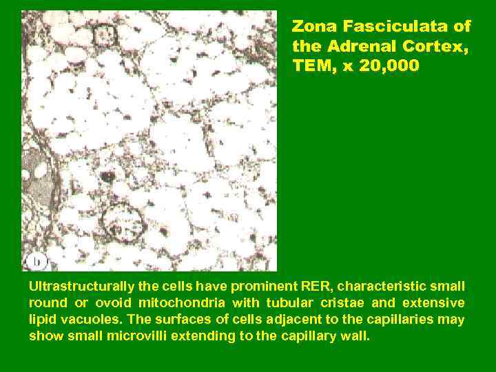 Zona Fasciculata of the Adrenal Cortex, TEM, x 20, 000 Ultrastructurally the cells have