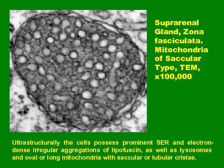 Suprarenal Gland, Zona fasciculata. Mitochondria of Saccular Type, TEM, x 100, 000 Ultrastructurally the