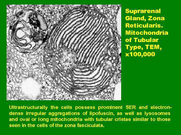 Suprarenal Gland, Zona Reticularis. Mitochondria of Tubular Type, TEM, x 100, 000 Ultrastructurally the