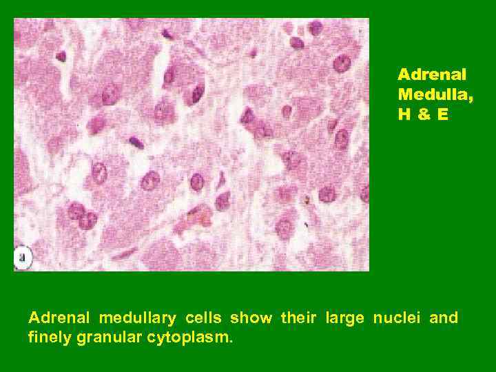 Adrenal Medulla, H&E Adrenal medullary cells show their large nuclei and finely granular cytoplasm.