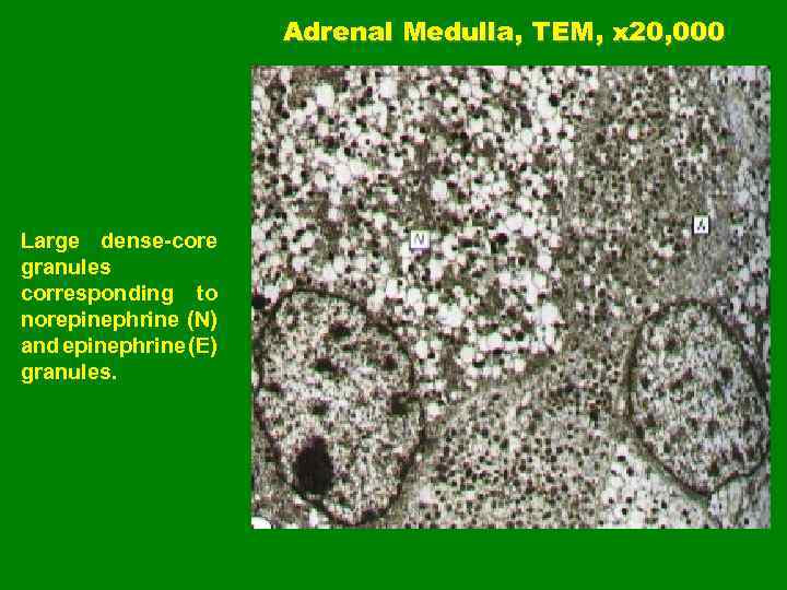 Adrenal Medulla, TEM, x 20, 000 Large dense-core granules corresponding to norepinephrine (N) and