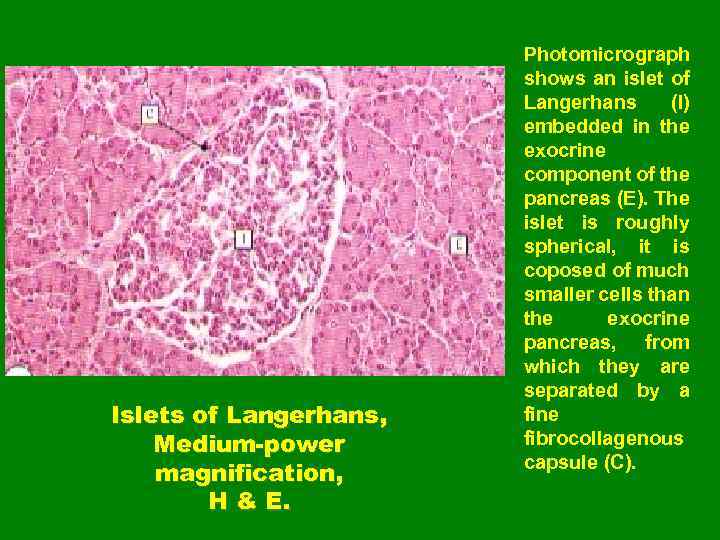 Islets of Langerhans, Medium-power magnification, H & E. Photomicrograph shows an islet of Langerhans