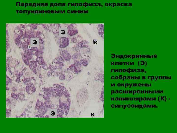 Передняя доля гипофиза, окраска толуидиновым синим Э к Э Э Эндокринные клетки (Э) гипофиза,