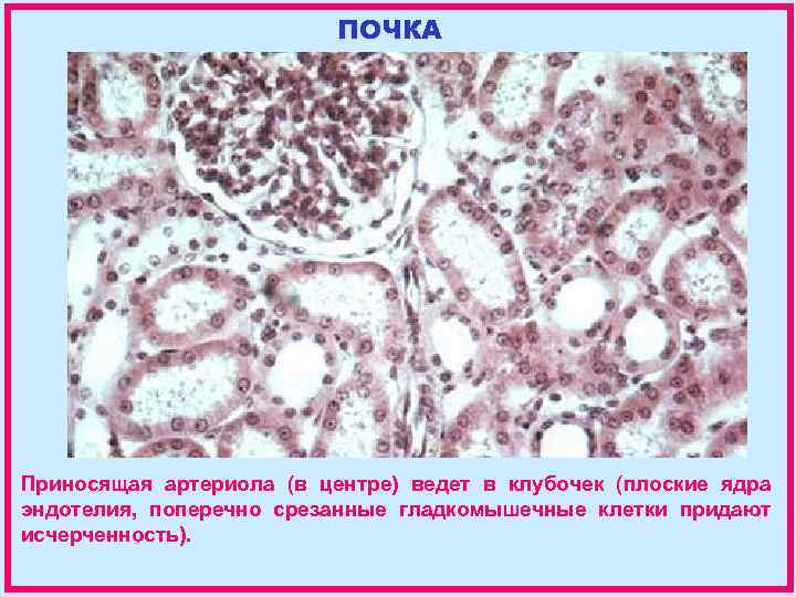 ПОЧКА Приносящая артериола (в центре) ведет в клубочек (плоские ядра эндотелия, поперечно срезанные гладкомышечные