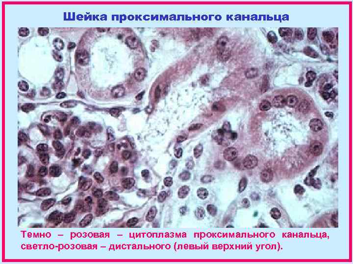 Шейка проксимального канальца Темно – розовая – цитоплазма проксимального канальца, светло-розовая – дистального (левый