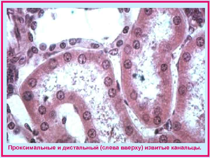 Проксимальные и дистальный (слева вверху) извитые канальцы. 