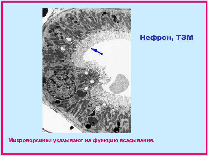 Нефрон, ТЭМ Микроворсинки указывают на функцию всасывания. 