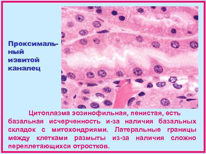 Цитоплазма эозинофилов. Эозинофильная цитоплазма. Базальная исчерченность. Пенистые клетки гистология.