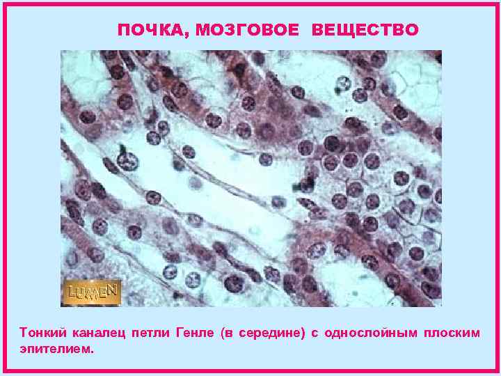 ПОЧКА, МОЗГОВОЕ ВЕЩЕСТВО Тонкий каналец петли Генле (в середине) с однослойным плоским эпителием. 