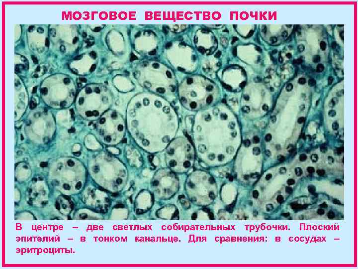 МОЗГОВОЕ ВЕЩЕСТВО ПОЧКИ В центре – две светлых собирательных трубочки. Плоский эпителий – в