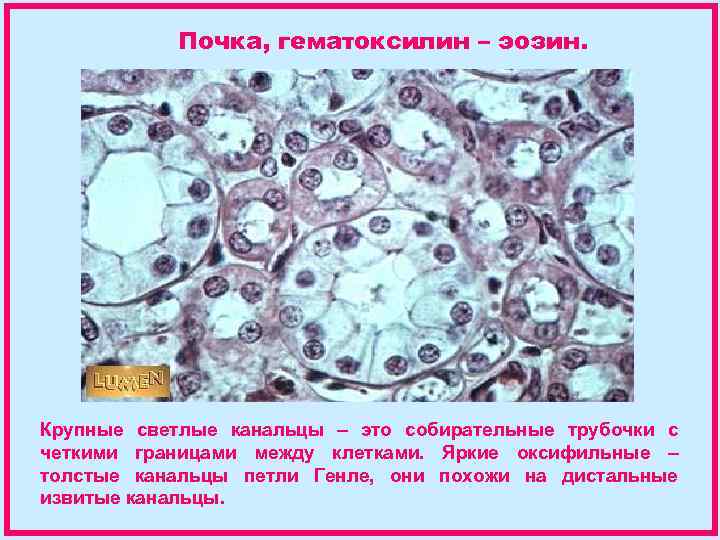 Почка, гематоксилин – эозин. Крупные светлые канальцы – это собирательные трубочки с четкими границами