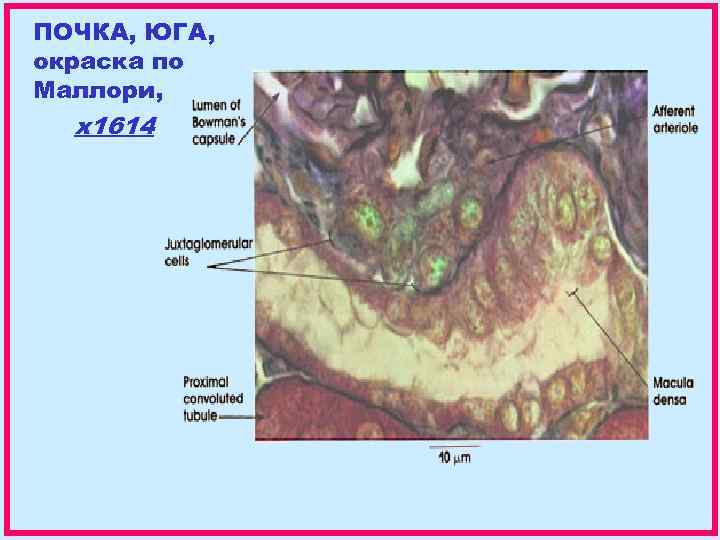 ПОЧКА, ЮГА, окраска по Маллори, x 1614 