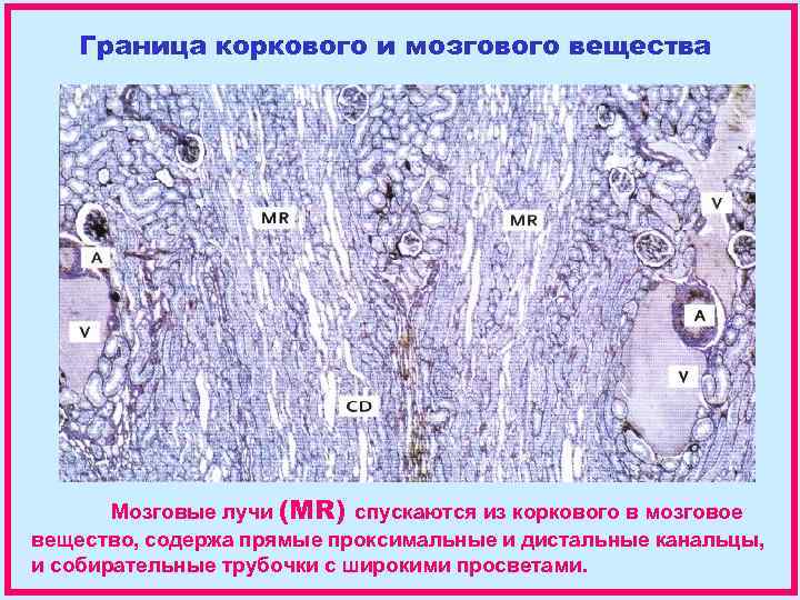 Граница коркового и мозгового вещества Мозговые лучи (MR) спускаются из коркового в мозговое вещество,