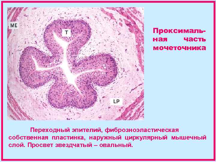 Проксимальная часть мочеточника Переходный эпителий, фиброзноэластическая собственная пластинка, наружный циркулярный мышечный слой. Просвет звездчатый