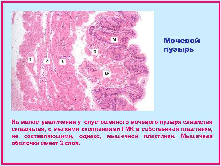 Мочевой пузырь На малом увеличении у опустошенного мочевого пузыря слизистая складчатая, с мелкими скоплениями