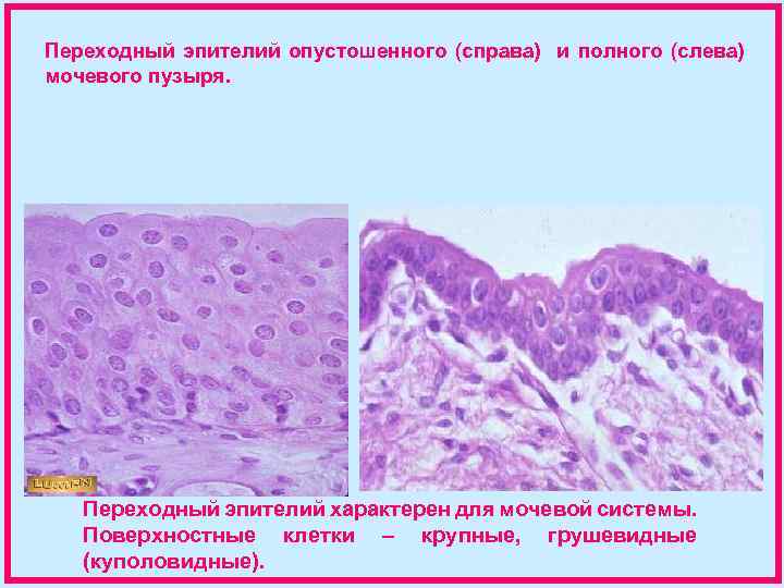Переходный эпителий опустошенного (справа) и полного (слева) мочевого пузыря. Переходный эпителий характерен для мочевой