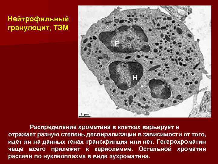 Нейтрофильный гранулоцит, ТЭМ E H Распределение хроматина в клетках варьирует и отражает разную степень