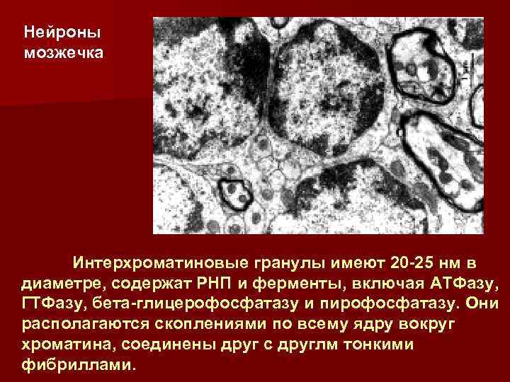Нейроны мозжечка Интерхроматиновые гранулы имеют 20 -25 нм в диаметре, содержат РНП и ферменты,