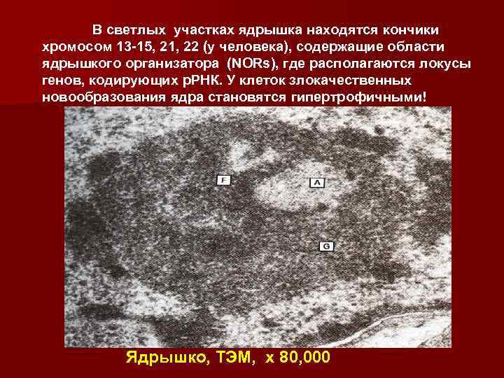 В светлых участках ядрышка находятся кончики хромосом 13 -15, 21, 22 (у человека), содержащие