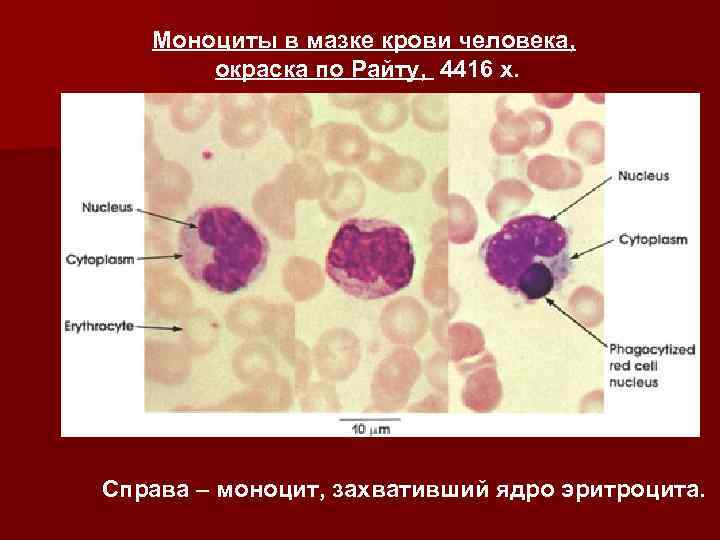 Моноциты в мазке крови человека, окраска по Райту, 4416 x. Справа – моноцит, захвативший