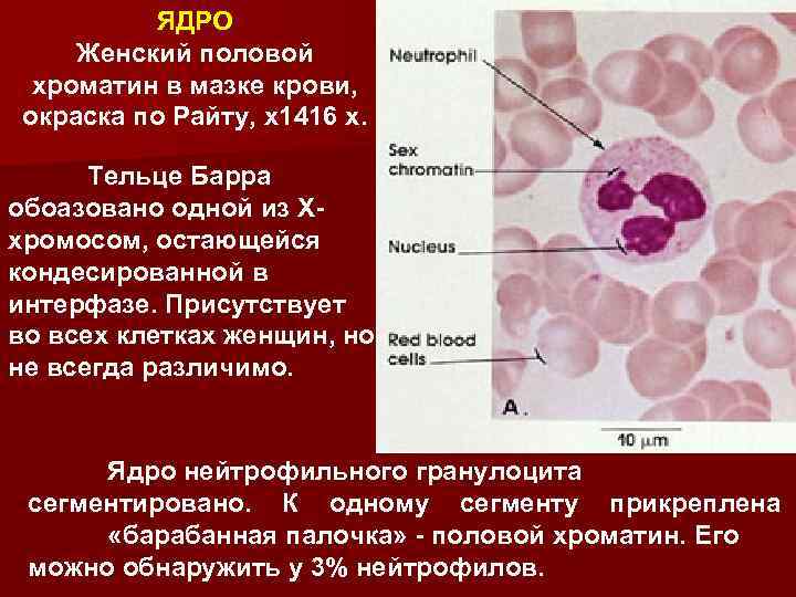 Что такое тельце барра. Тельце Барра хроматин. Тельца Барра.