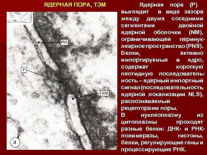 ЯДЕРНАЯ ПОРА, TЭM Ядерная пора (Р) выглядит в виде зазора между двумя соседними сегментами