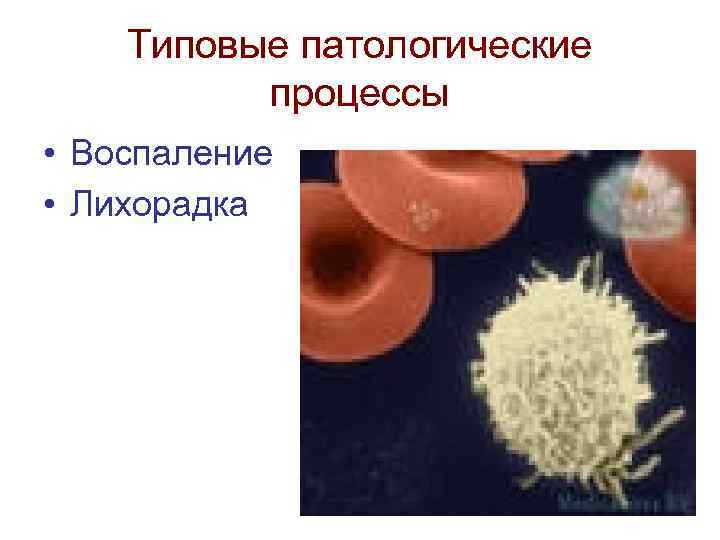 Воспаление типовой патологический процесс. Типовые патологические процессы. Лихорадка это типовой патологический процесс. Типичные патологические процессы.