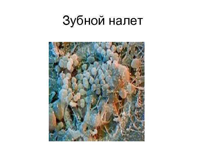 Зубной налет 