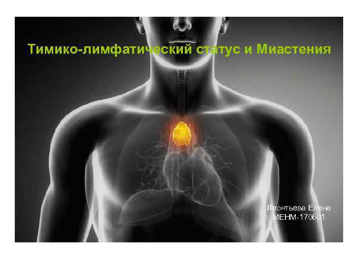 Тимико-лимфатический статус и Миастения      Леонтьева Елена   