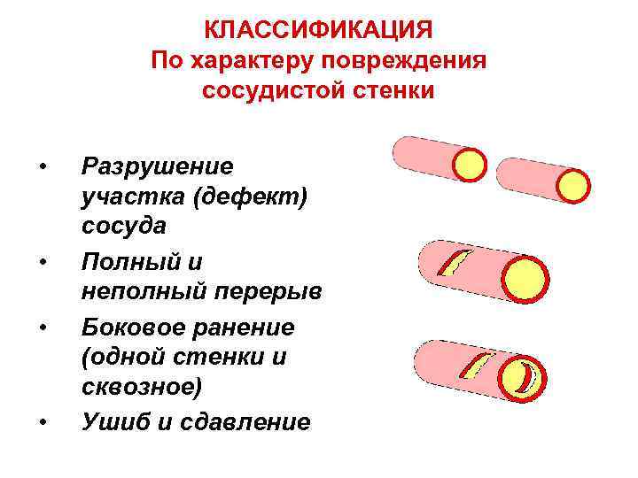 Какой сосуд поврежден на рисунке 1