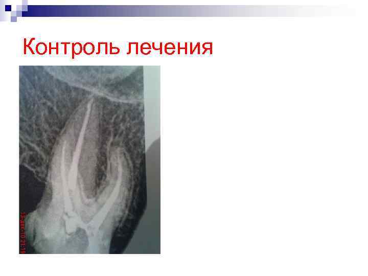 Контроль лечения Контроль лечения