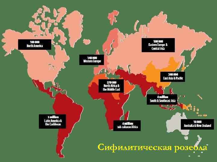 Сифилитическая розеола 