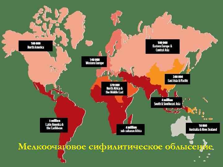 Мелкоочаговое сифилитическое облысение 