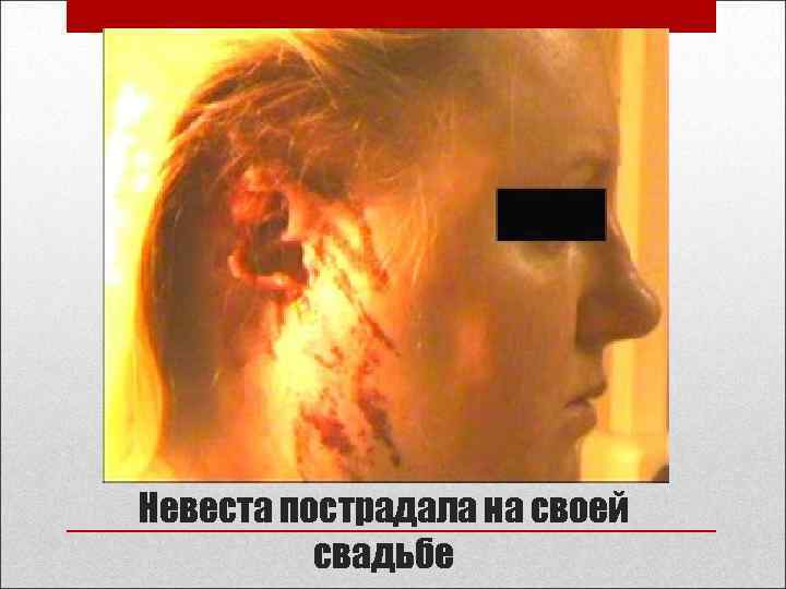 Невеста пострадала на своей свадьбе 