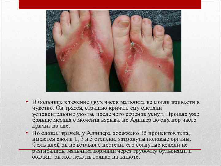  • В больнице в течение двух часов мальчика не могли привести в чувство.