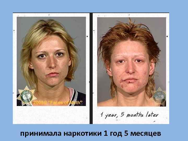   принимала наркотики 1 год 5 месяцев 