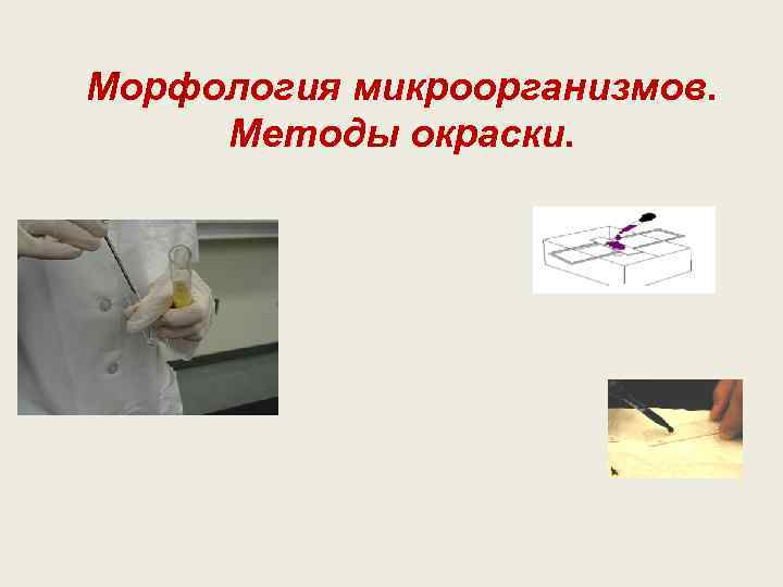 Морфология микроорганизмов.  Методы окраски. 