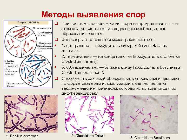     Методы выявления спор      q При
