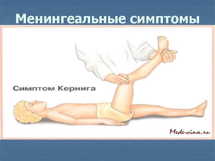 Менингеальные симптомы 