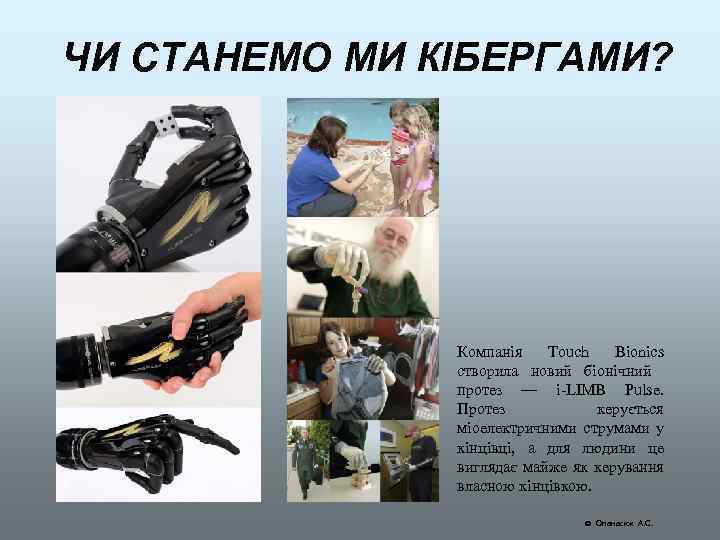 ЧИ СТАНЕМО МИ КІБЕРГАМИ? Компанія Touch Bionics створила новий біонічний протез — i-LIMB Pulse.