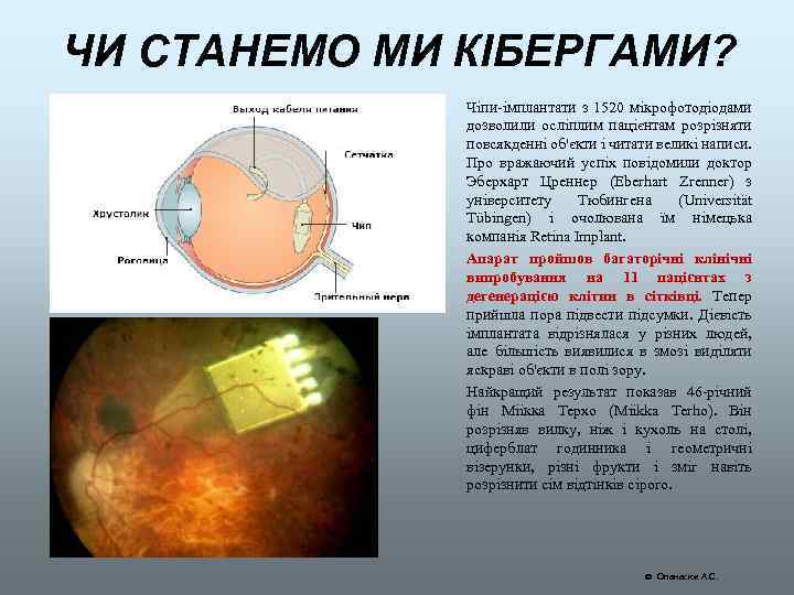 ЧИ СТАНЕМО МИ КІБЕРГАМИ? Чіпи-імплантати з 1520 мікрофотодіодами дозволили осліплим пацієнтам розрізняти повсякденні об'єкти