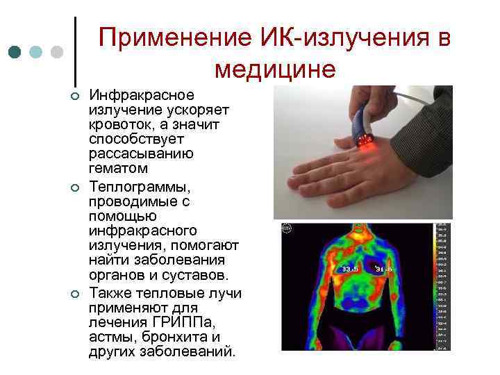 Ионизирующее излучение в медицине презентация