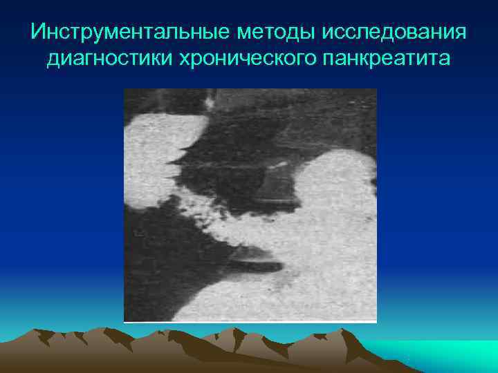 Инструментальные методы исследования диагностики хронического панкреатита 
