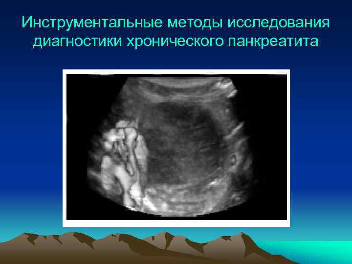 Инструментальные методы исследования диагностики хронического панкреатита 
