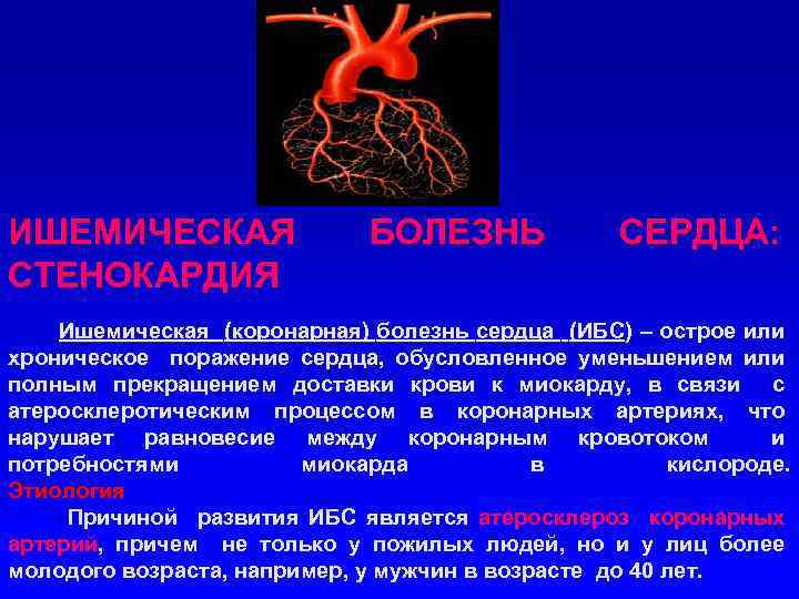 ИШЕМИЧЕСКАЯ СТЕНОКАРДИЯ БОЛЕЗНЬ СЕРДЦА: Ишемическая (коронарная) болезнь сердца (ИБС) – острое или хроническое поражение